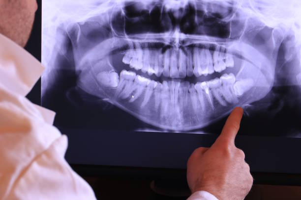 Best Emergency Treatment for Jaw Pain or Injury in Glenmora, LA